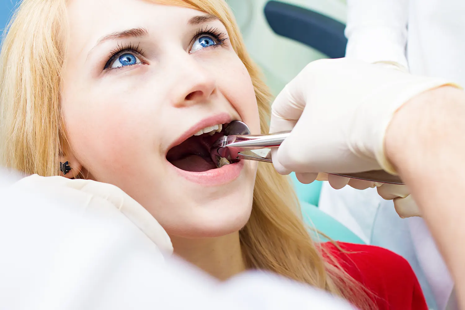 How Long After Wisdom Teeth Removal Can I Eat?