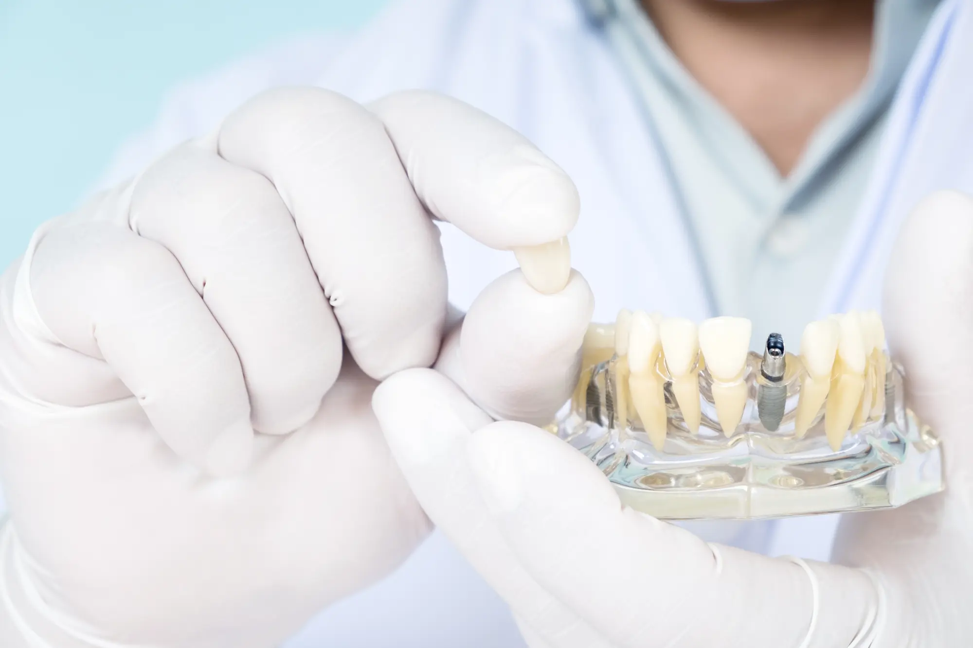 Dental Implants vs. Dentures: Choosing the Right Option for Missing Teeth