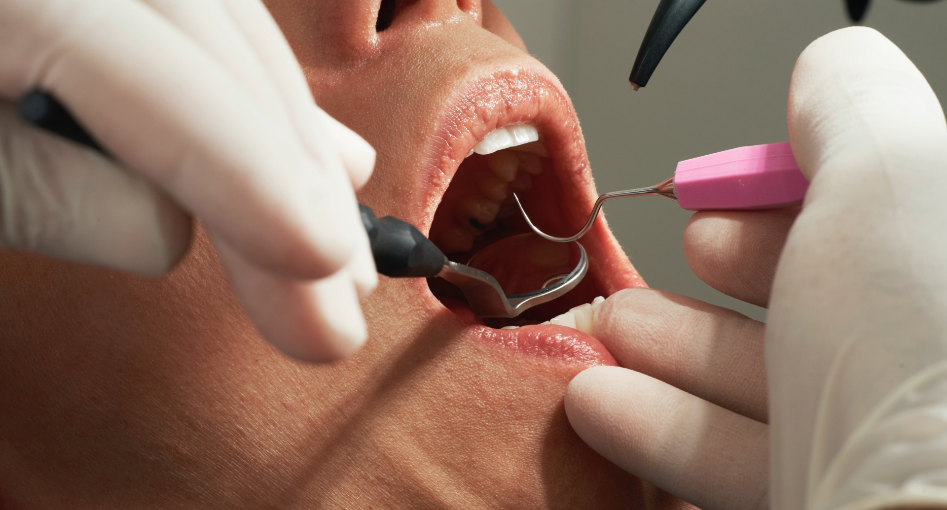 Emergency Dental Care