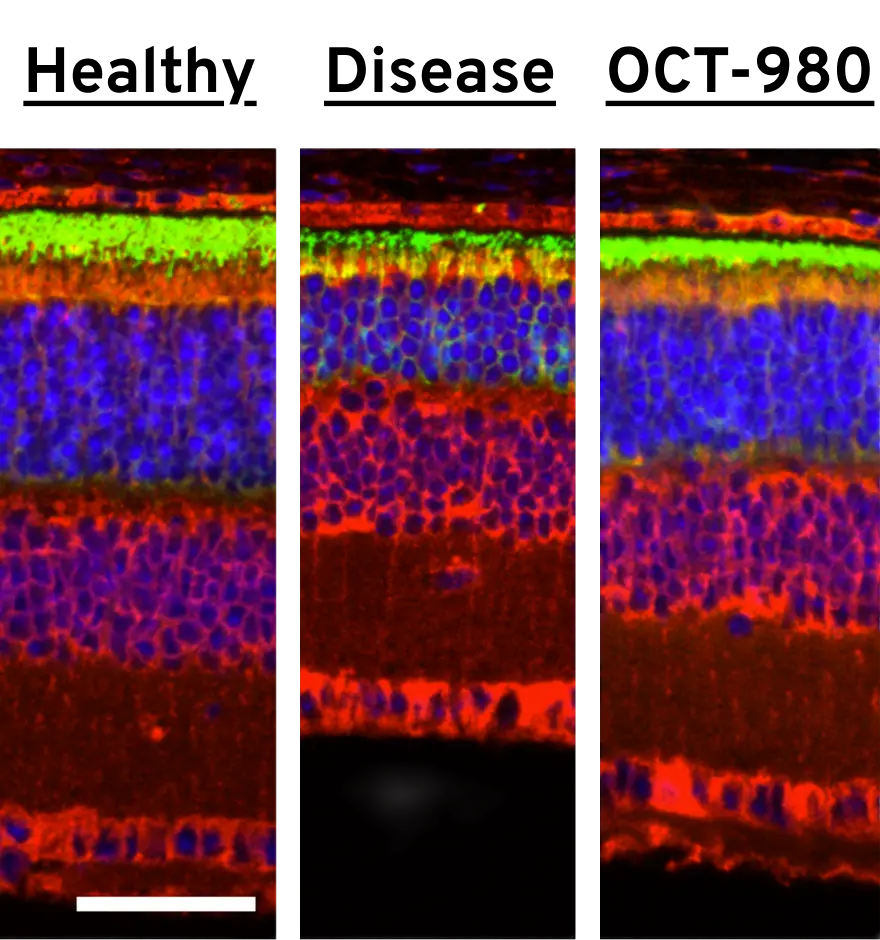 Comparison between the retinal structure of a healthy retina, diseased retina, and a retina with OCT-980 treatment