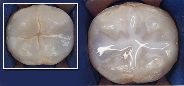 Growing Smiles Main Line Pediatric Dentistry