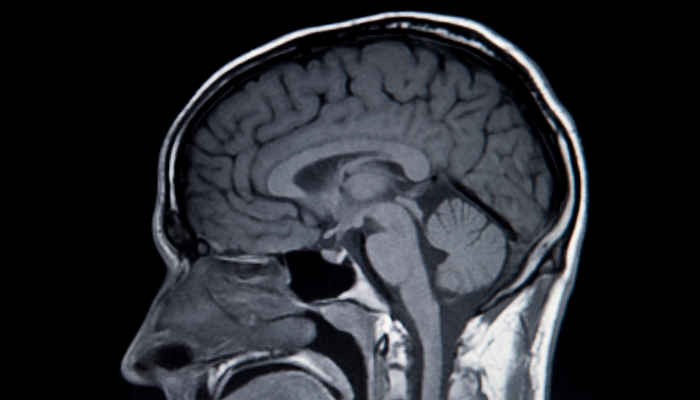 Understanding MRI, CT, and EEG: What to Expect and Why They’re Ordered