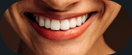 Sonrisa de paciente