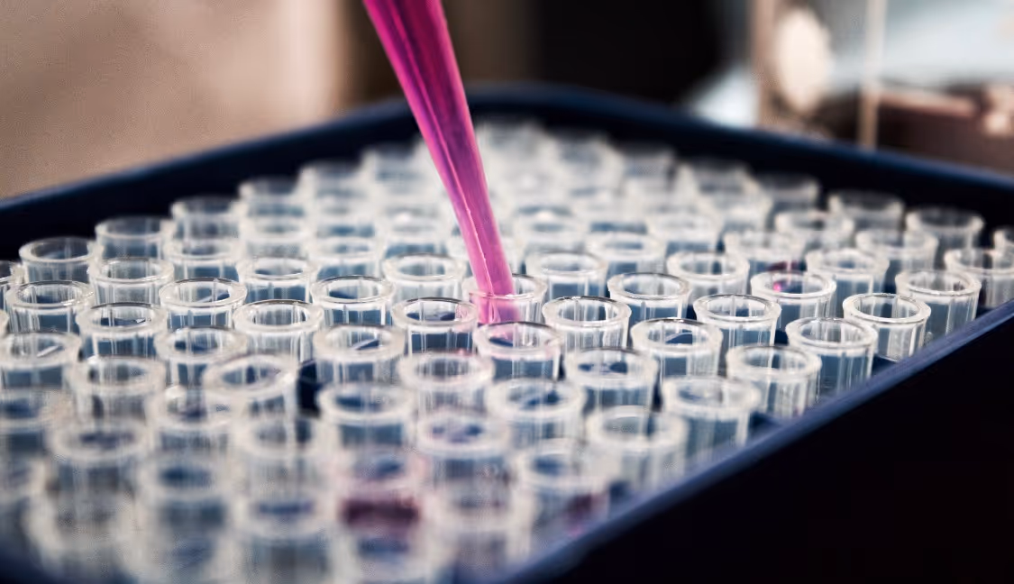 IVDR: In Vitro Diagnostic Regulation within the European Union