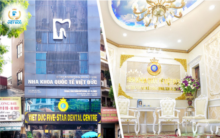 trồng răng implant uy tín tại hà nội