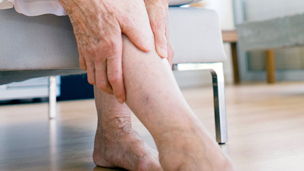 Patient with leg pain