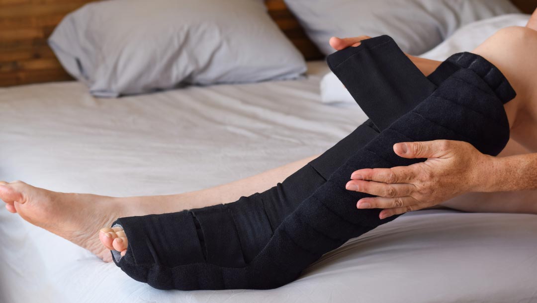 UKVeinClinic - Compression bandages for lymphoedema