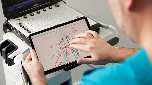 UK Vein Clinic – Duplex ultrasound scan
