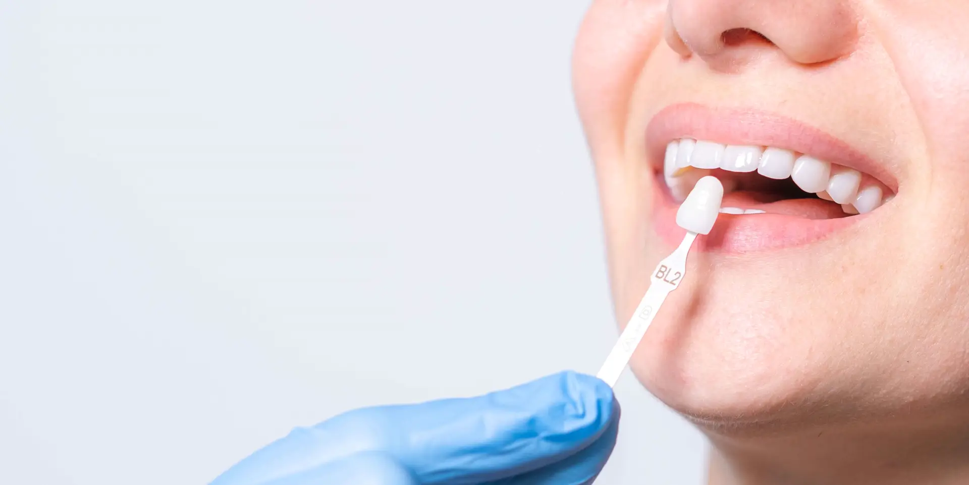 Dentist holding a shade guide to a patient's teeth to match porcelain veneers in Staten Island