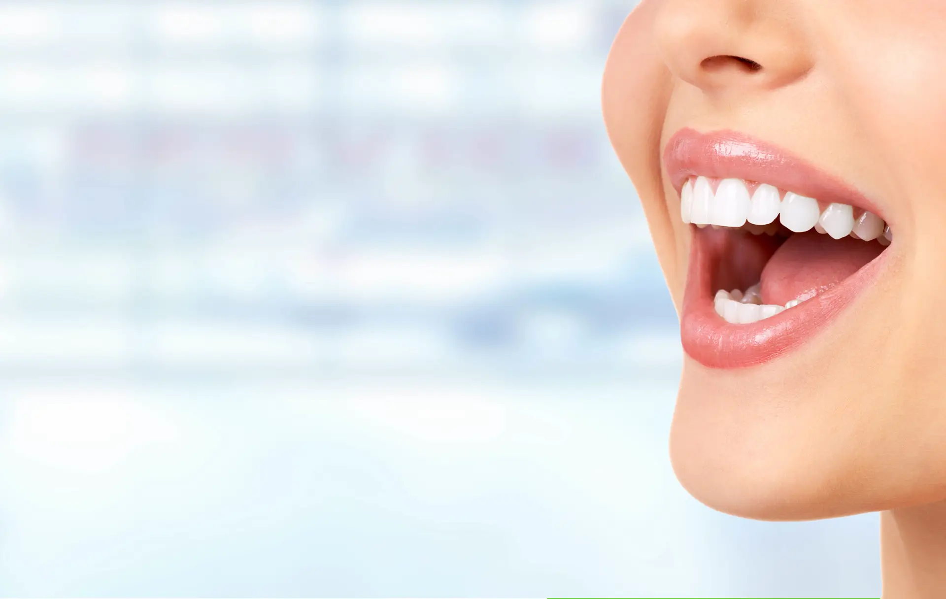 Close-up of a wide, even smile after a smile makeover in Staten Island