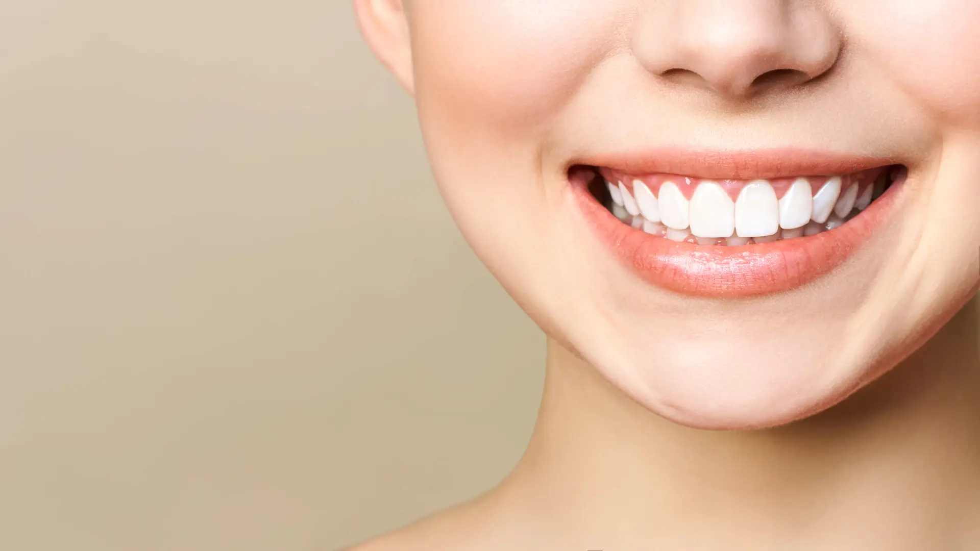 Close-up of a bright white smile after teeth whitening in Staten Island