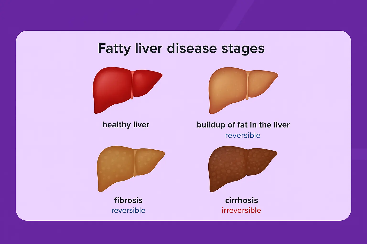 Fatty liver cases 