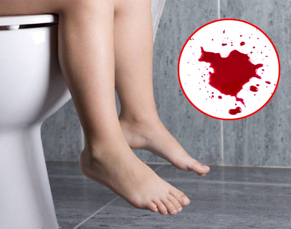 đi ngoài ra máu