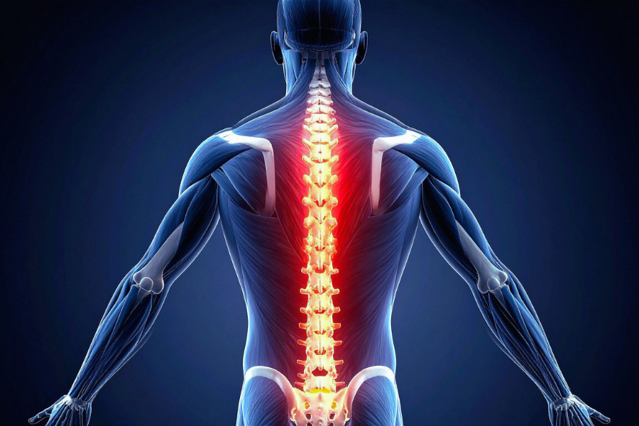 8 Alternatives to Spinal Cord Stimulator Implants