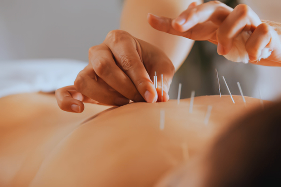 8 Alternatives to Acupuncture for Chronic Pain Relief