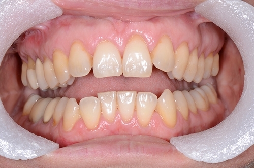 before and after treatment