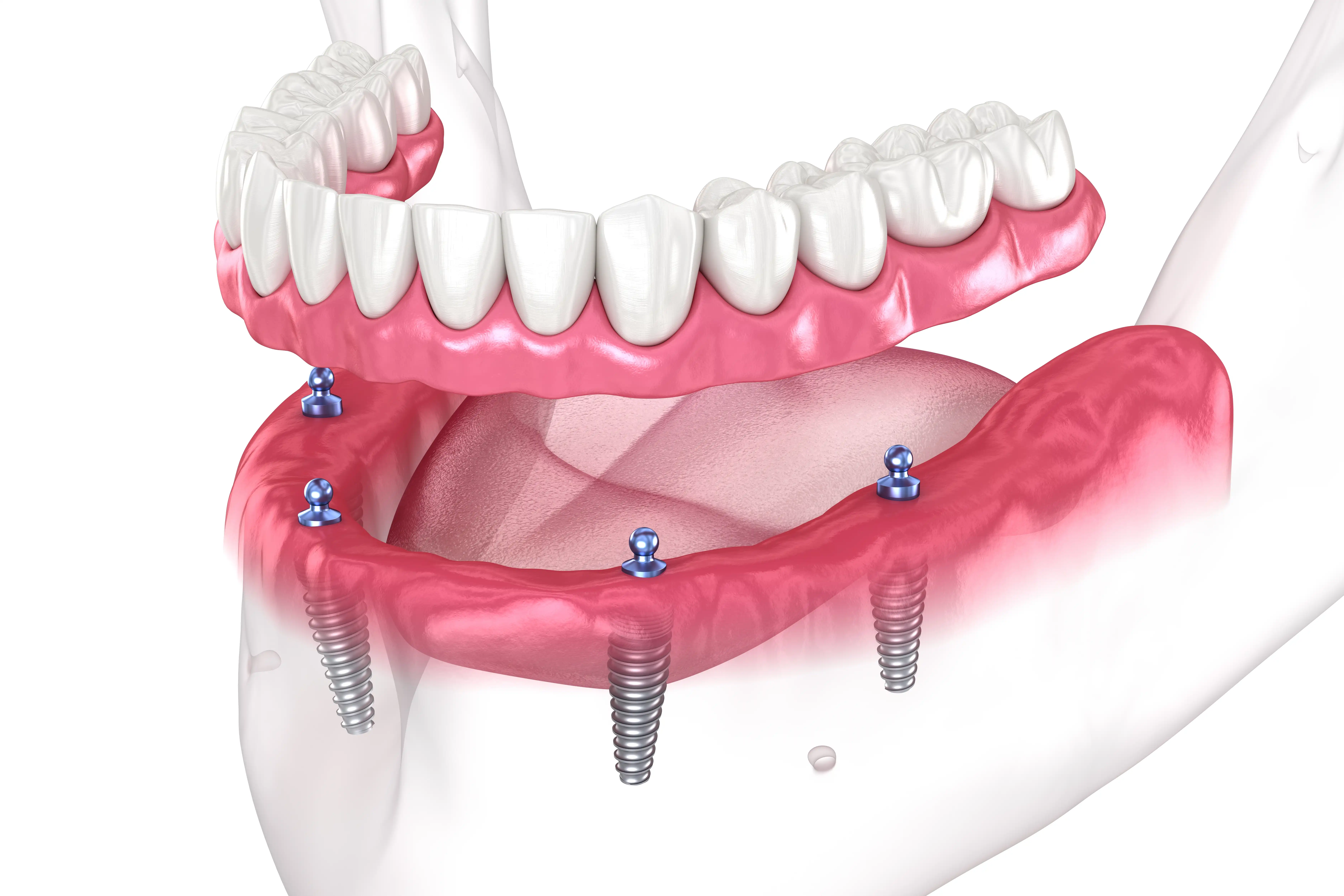 Dr Jena Ward dental appointment