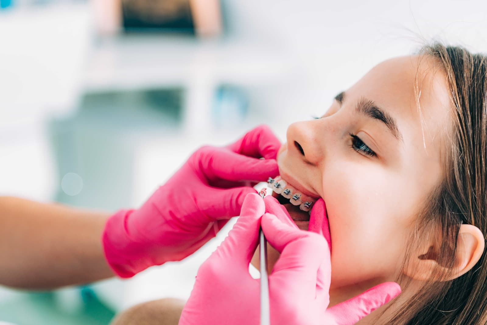 Dental Braces