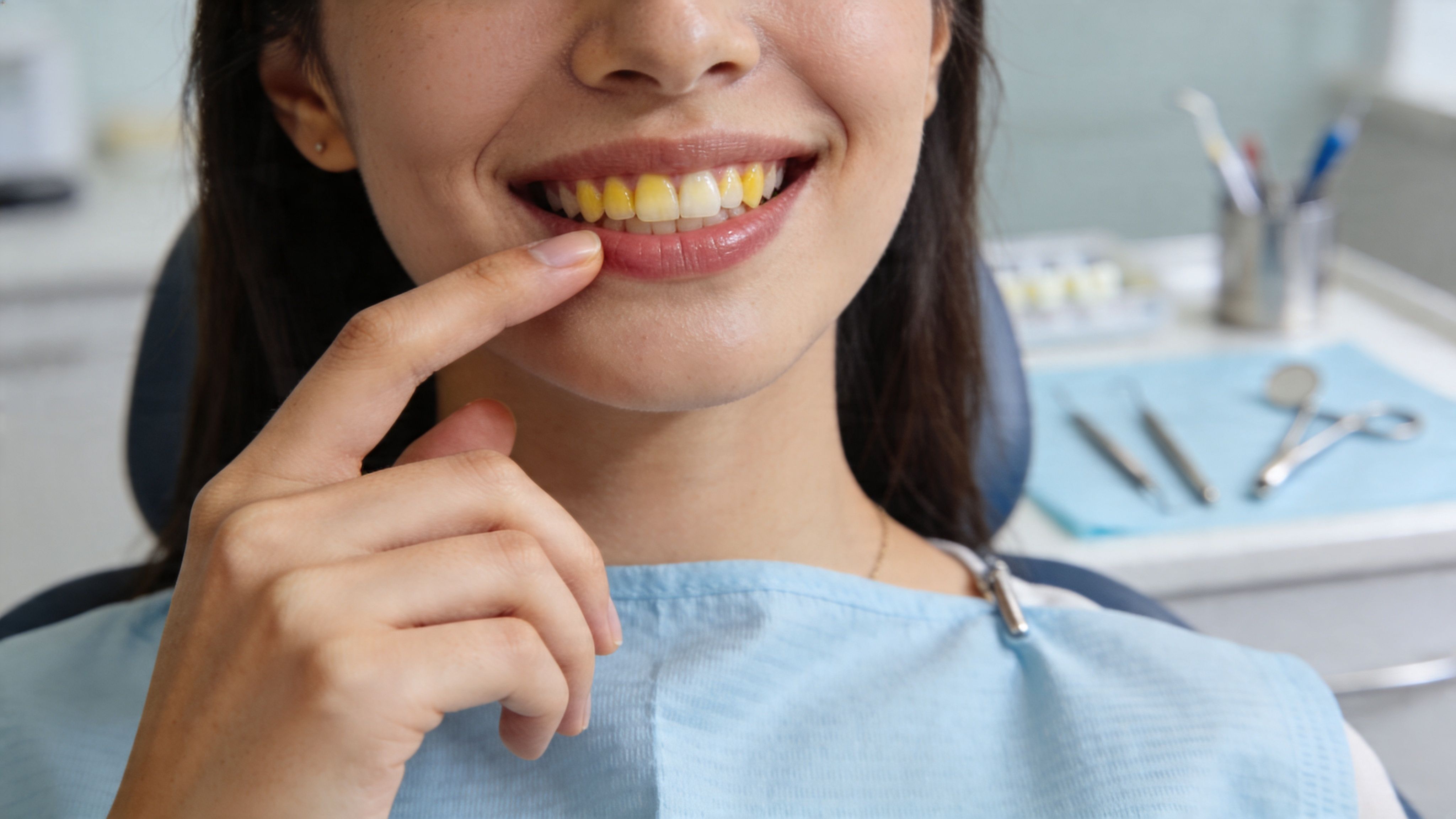 A close-up view of a woman in a dental office pointing to her stained yellow teeth.