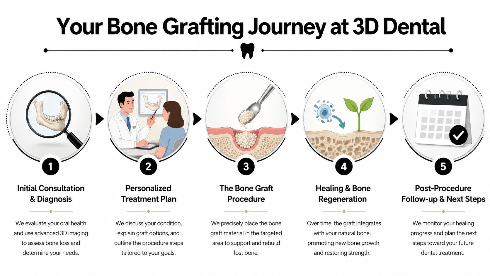 A step-by-step infographic illustrating the five stages of the dental bone grafting procedure at 3D Dental.