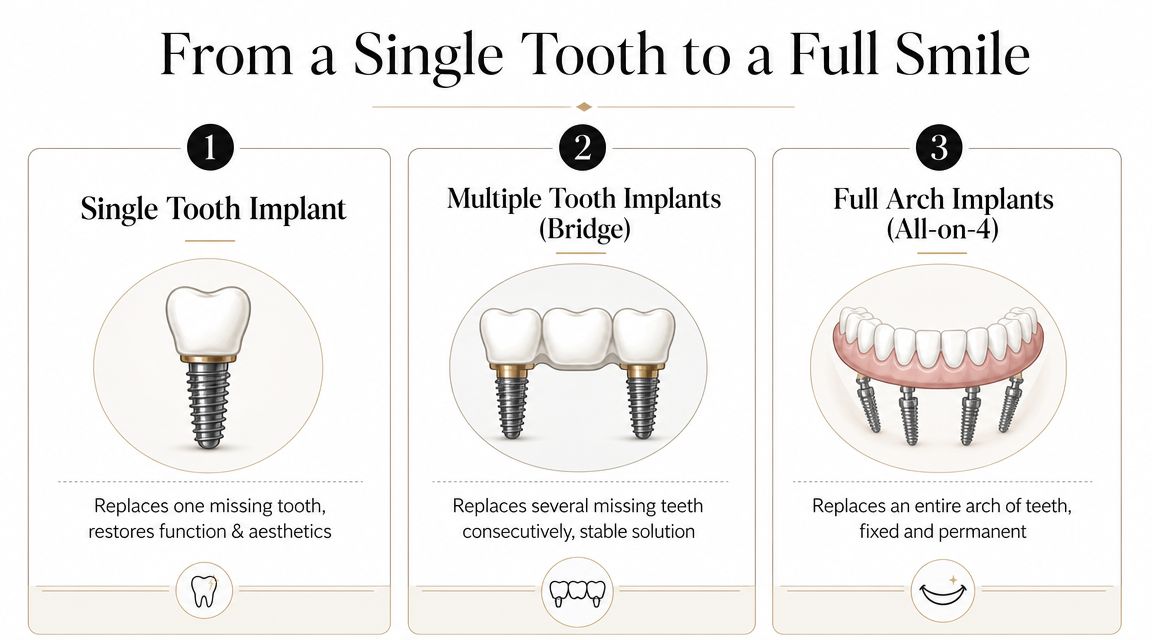 A diagram illustrating three types of dental implant solutions for single, multiple, and full arch tooth replacement.