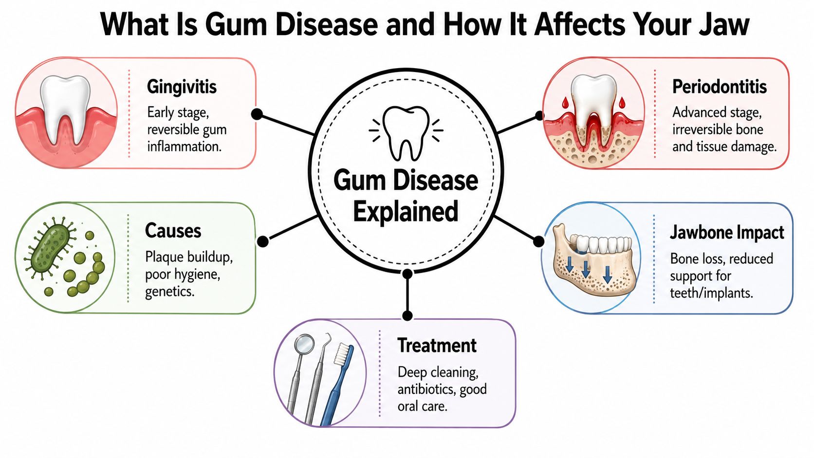 An infographic explaining gum disease, its causes, progression from gingivitis to periodontitis, jawbone impact, and available treatments.