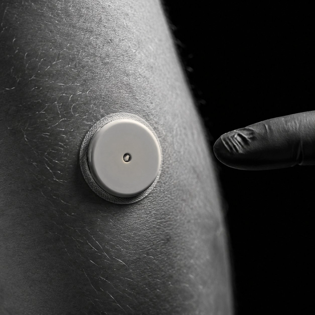 Close-up of a continuous glucose monitor sensor taped to bare skin as a gloved hand points toward it