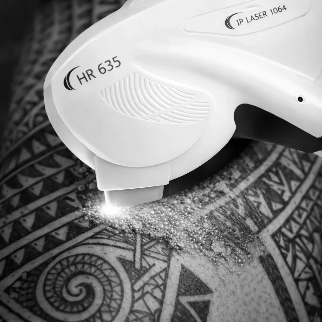 An HR 635 laser handpiece firing over heavily tattooed skin