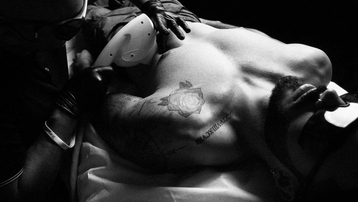 A reclining shirtless client being treated with a laser handpiece on the chest