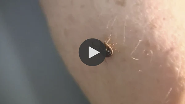 A tick on skin