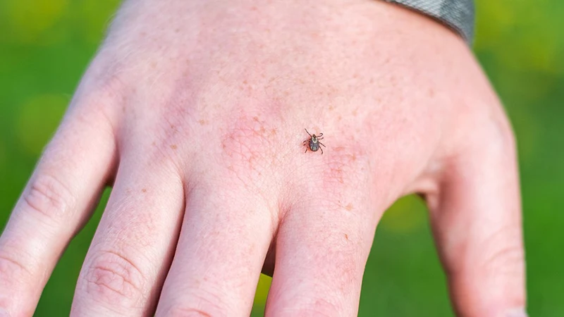 A tick on a hand.