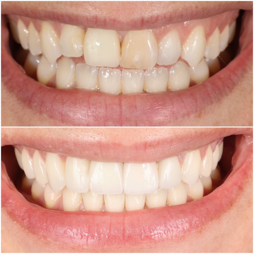 Before Image