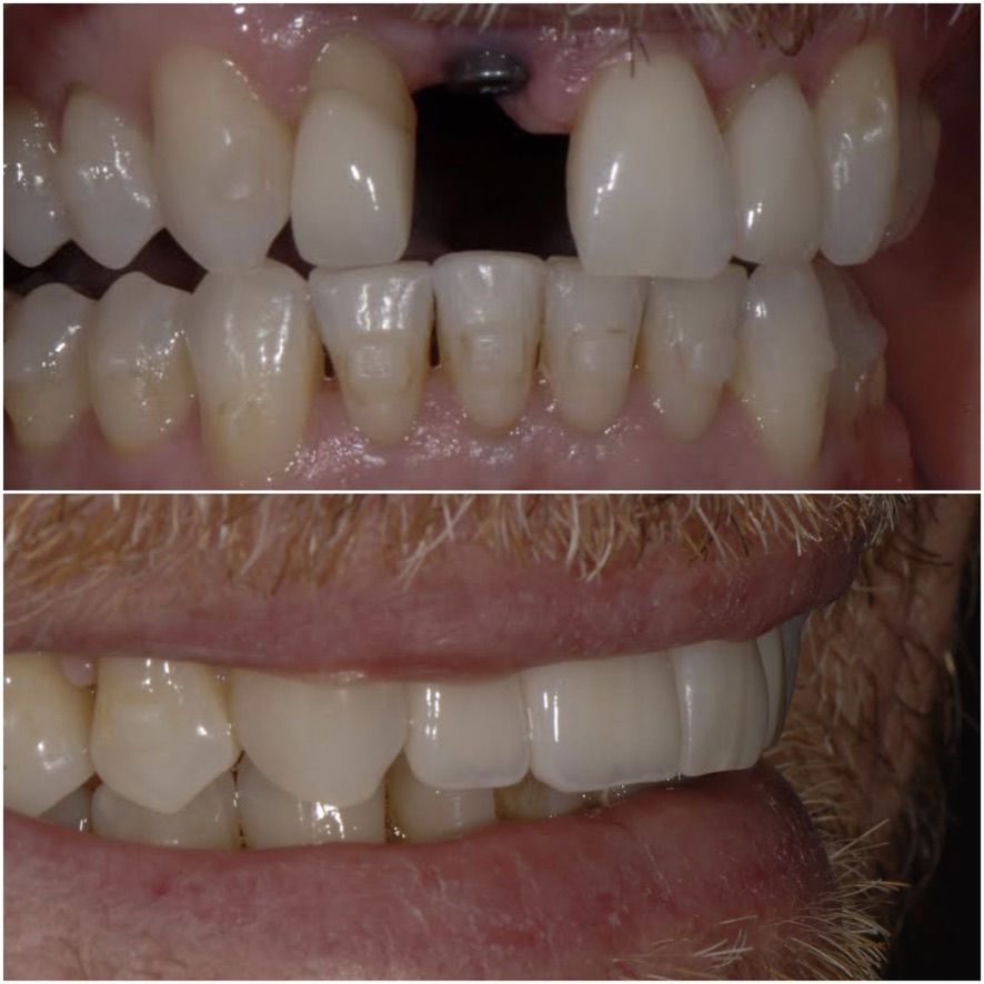 Before Image