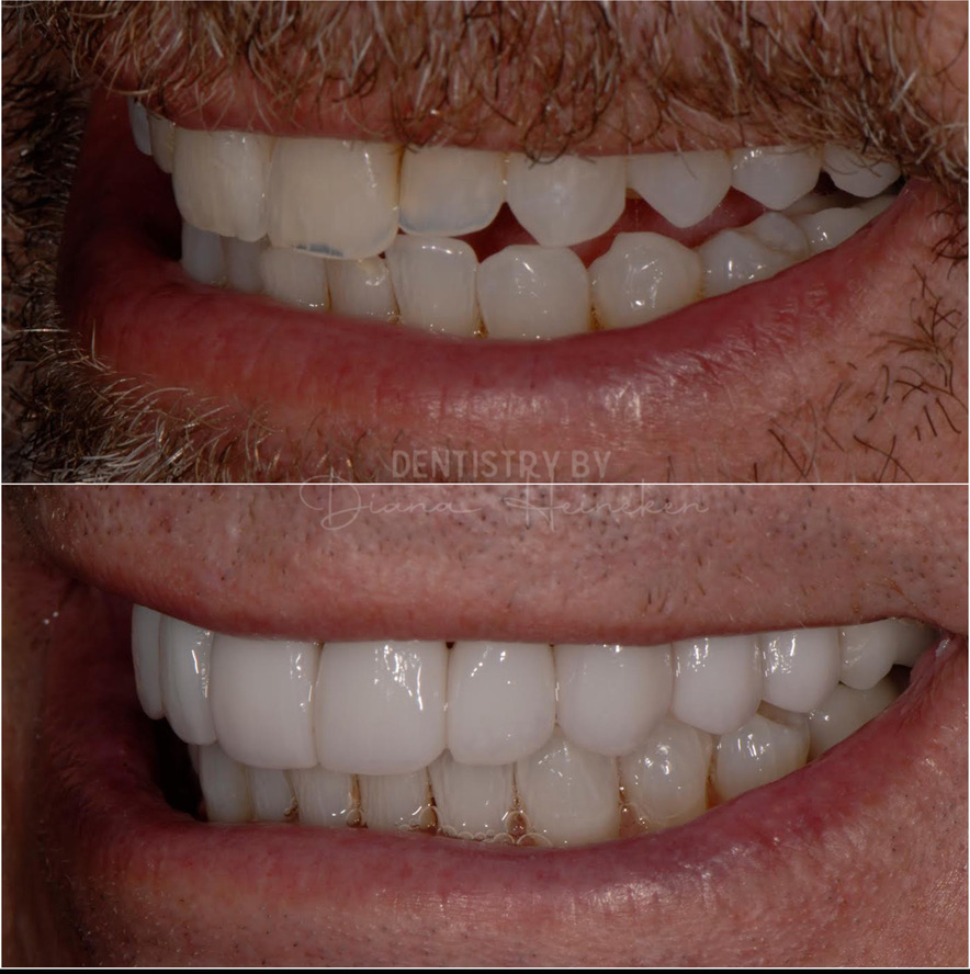 Before Image