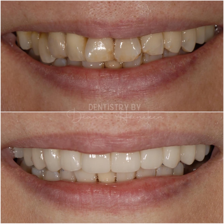 Before Image