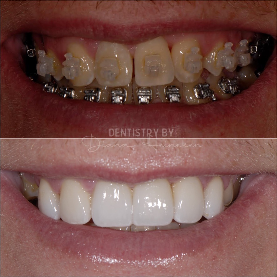 Before Image