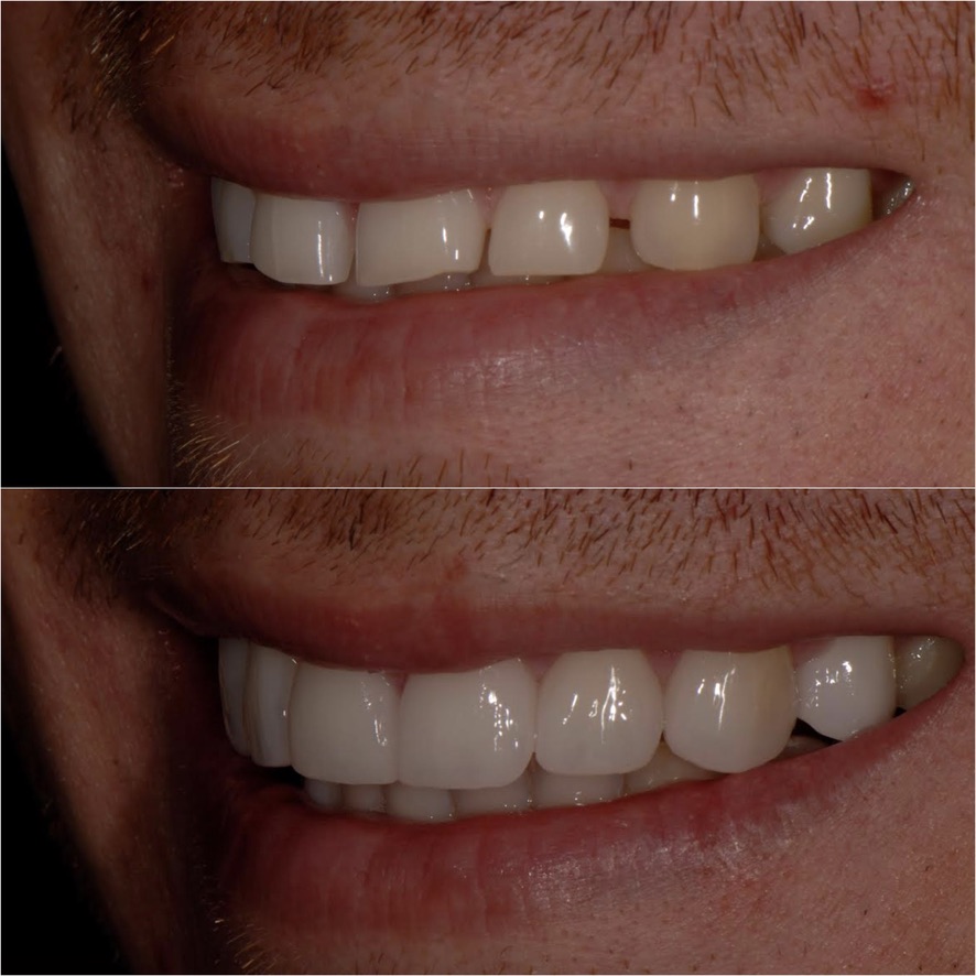 Before Image