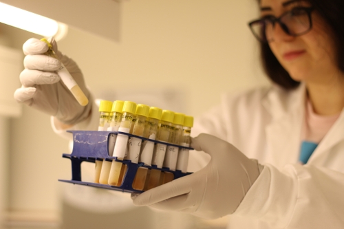 Prognosis of Muscle-Invasive Bladder Cancer