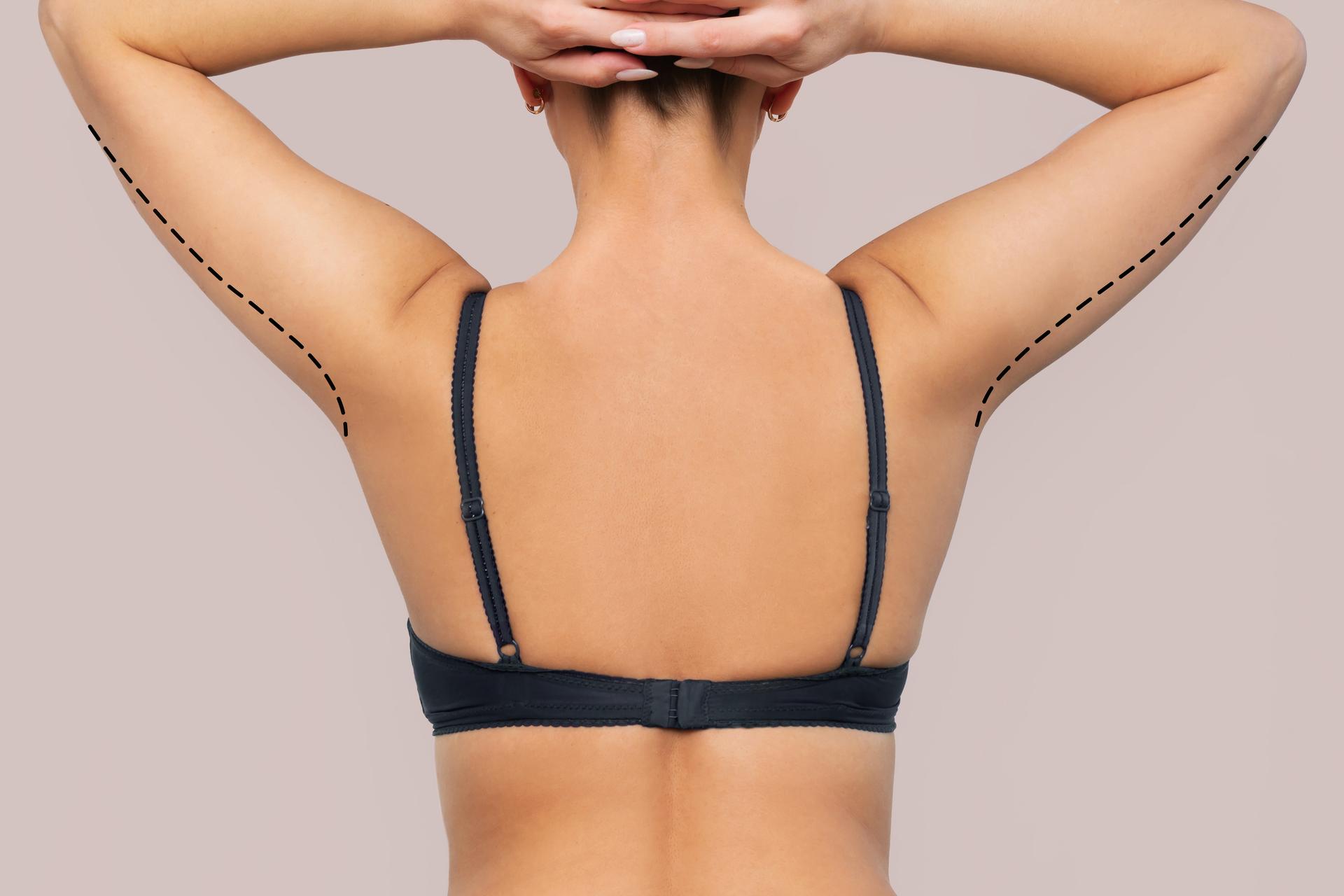 Mastectomy & Immediate Breast Reconstruction