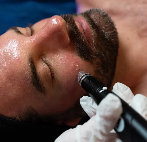 A man receives a Hydrafacial from his local Restore Hyper Wellness