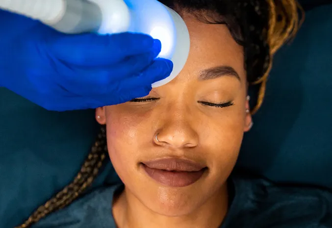 woman receiving hydrafacial