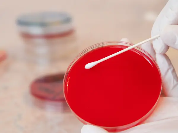 A blood agar plate, commonly used in urine culture, which aids in the diagnosis of UTI in dogs