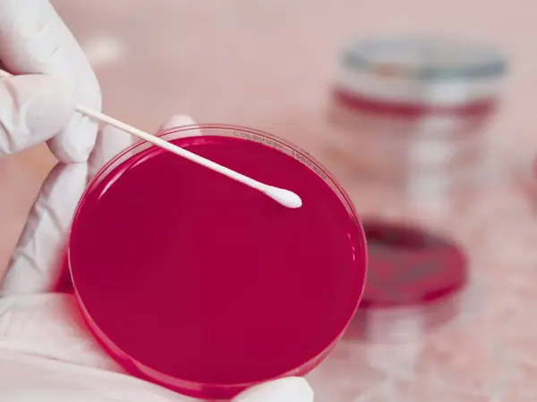 Closeup of an agar plate that can be used for urine culture and sensitivity, a lab test to diagnose or confirm cat UTI