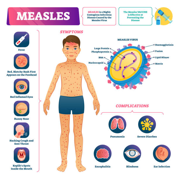 The Measles “Booster Problem” Is Mostly the Wrong Problem 