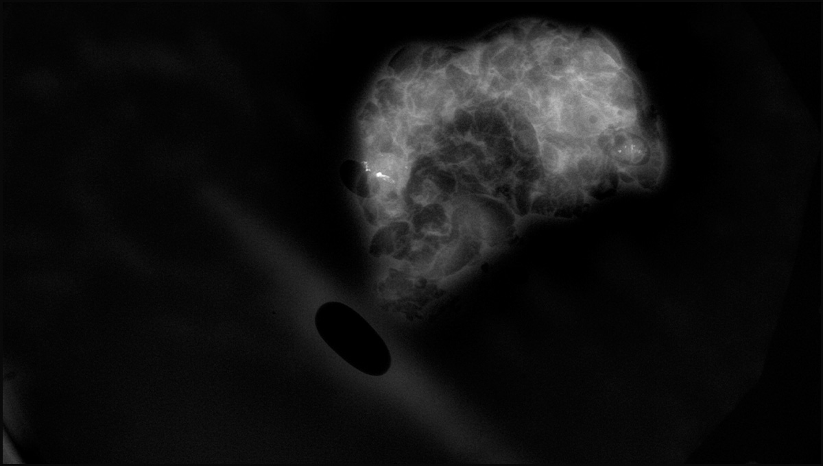 xpert 20 xray