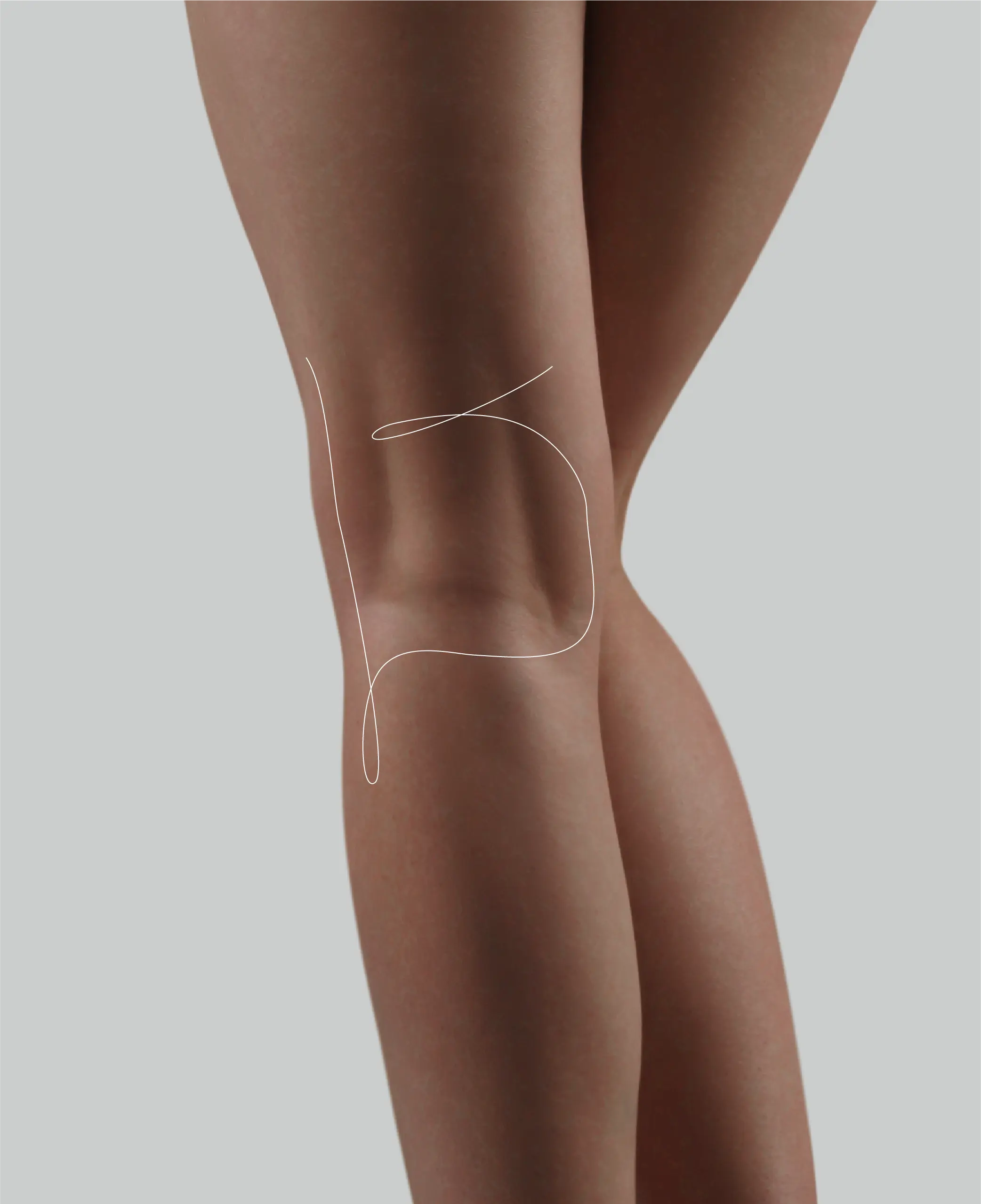 Correction of Concave Deformities