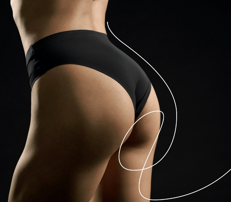 Augmentation des fesses