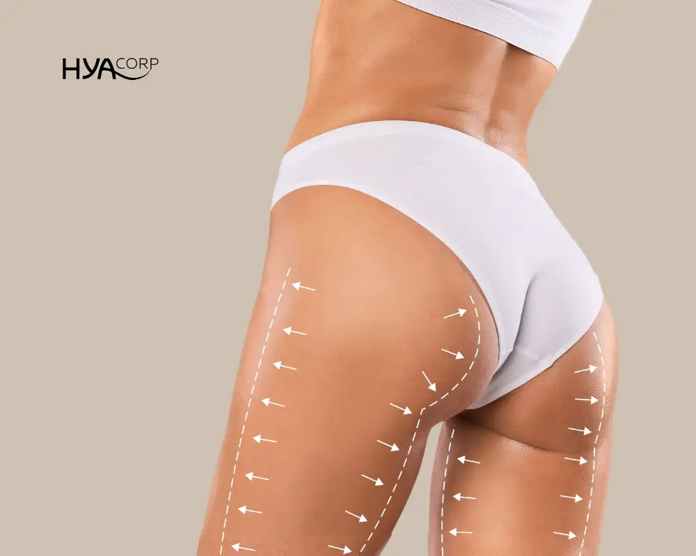 Hip Dip Filler vs. Buttock Augmentation: Which HYAcorp Treatment Is Right for You?