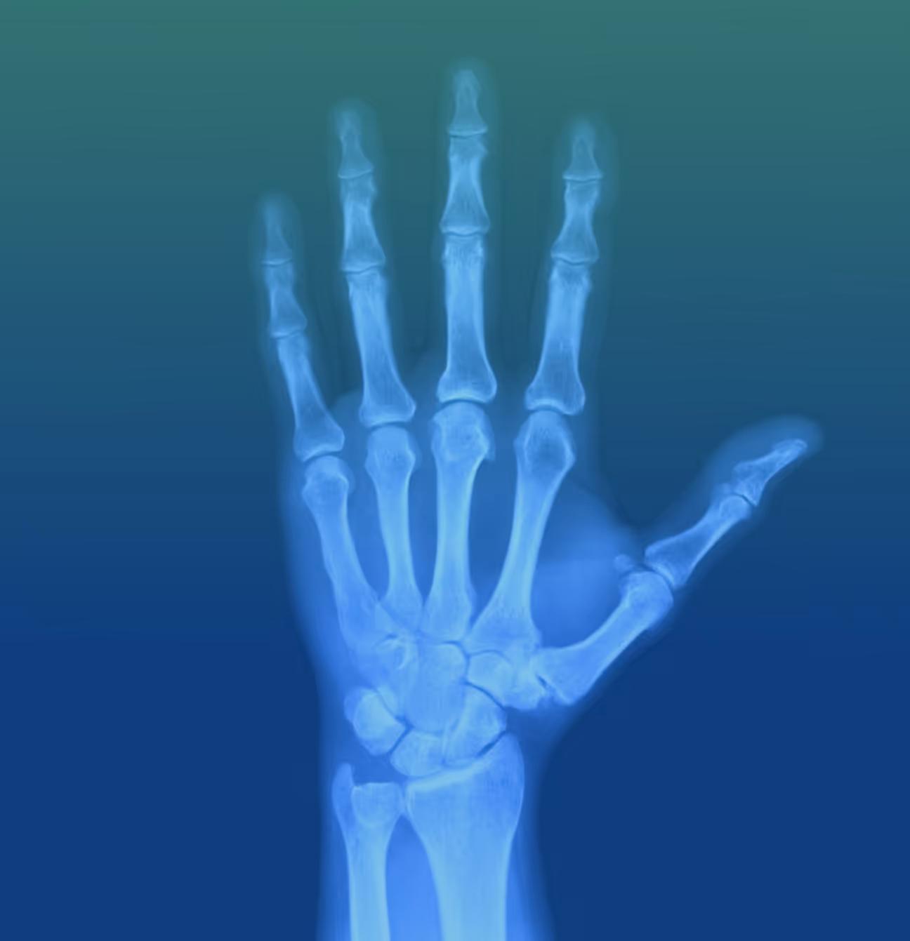 Data Signals: Your X-ray Vision into Private Markets