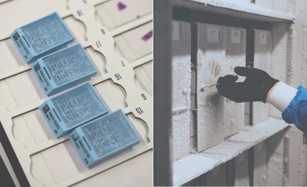 Frozen plasma, buffy coat, FFPE blocks and slides